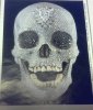 Für die Liebe Gottes 2007    Künstler  Damien Hirst   Platinschädel, Diamanten, menschliche Zähn.jpg